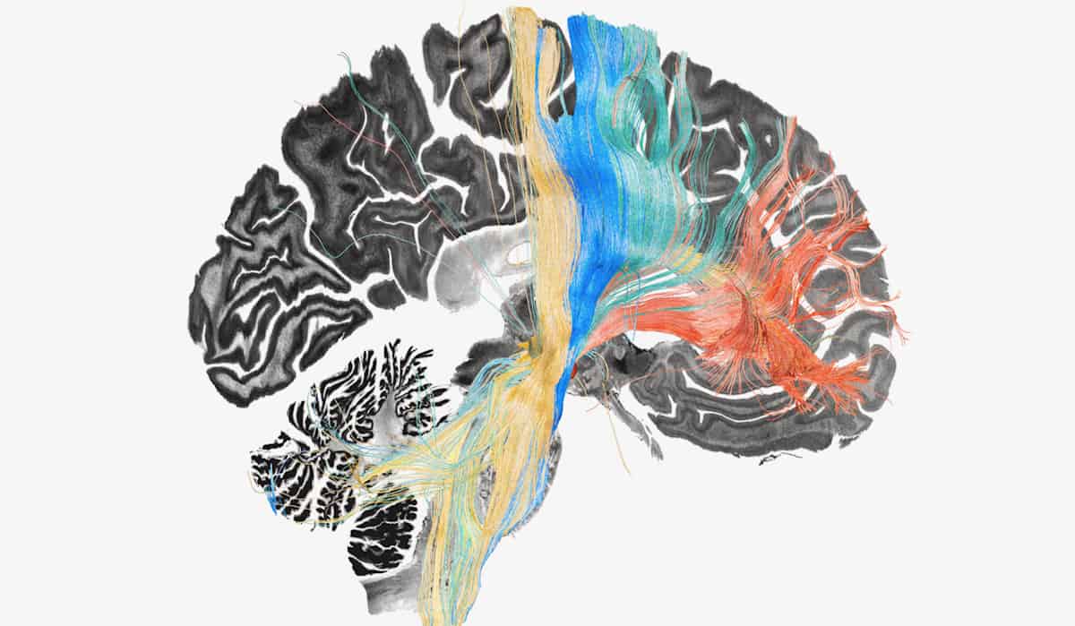 Brain Circuit Mapping: Conquering OCD & Identifying Treatment Targets