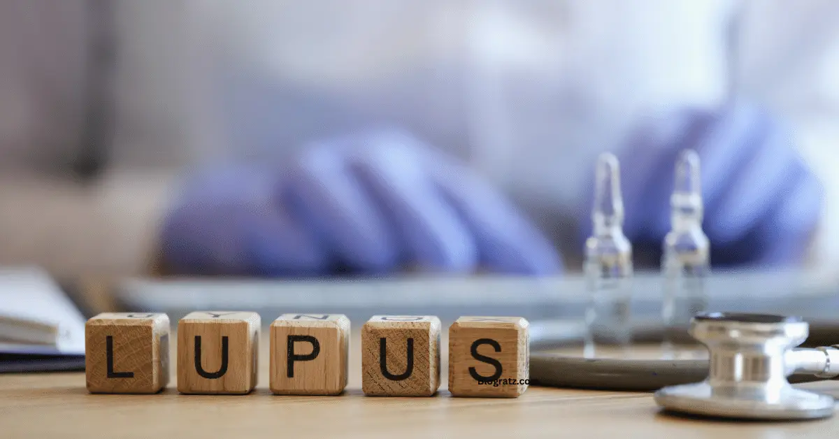 Ninety-one percent of lupus sufferers claim using steroids to control their symptoms.
